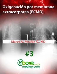 Oxigenación por membrana extracorpórea (ECMO) Artículo No. 3