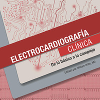 Electrocardiografía Clínica. De lo básico a lo complejo