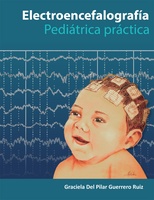 Electroencefalografía Pediatría Práctica